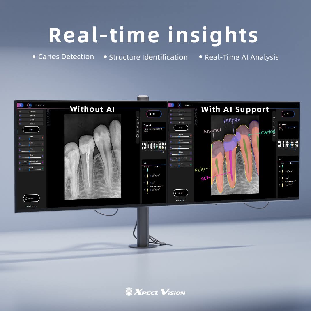 Xpect Vision RVG Sensor